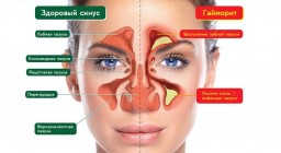 Последствие неправильного питания: скопление слизи в организме