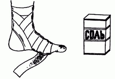 Лечение солью .