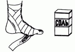 Лечение солью .