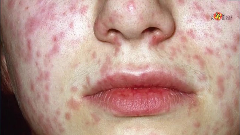 Разбираемся с прививками  Часть 3  Врачи