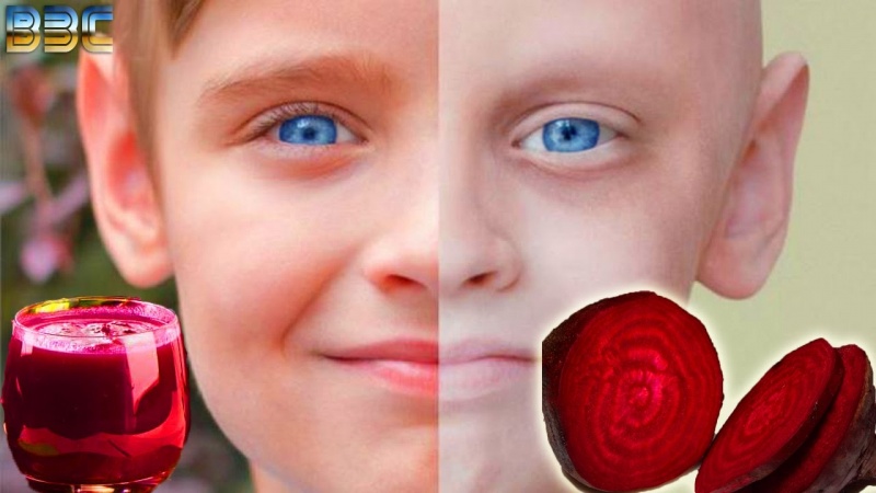 Вся правда о лечении Свеклой ( Вред и Польза ) | Лечение | Простуда Молочница Рак Диабет Регенерация