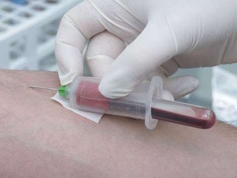 Какие врачи самые недолгоживущие? Александр Огулов