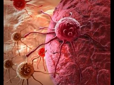 Почему в наше время люди массово болеют раком. Денис Малинов