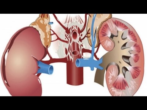 Как диагностировать почки самому? Александр Огулов