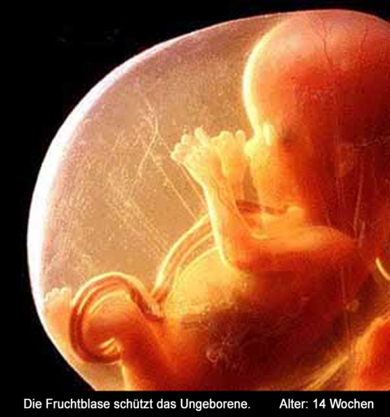 Пётр Гаряев: УЗИ стирает информацию из ДНК плода!