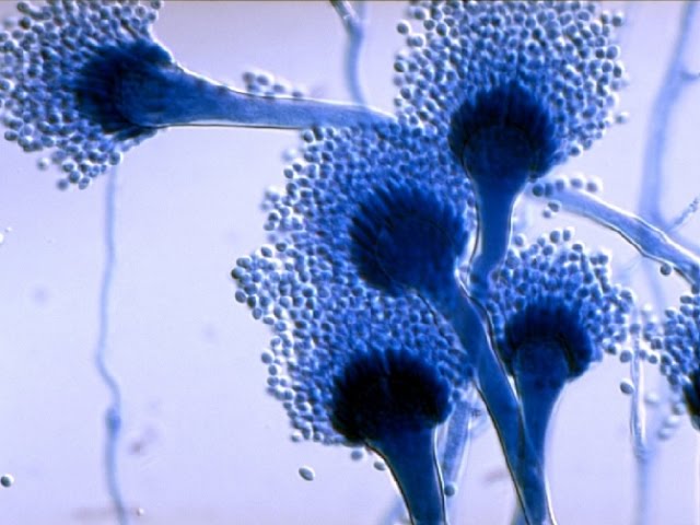 Как лечить хронический кандидоз? Алена Полынь