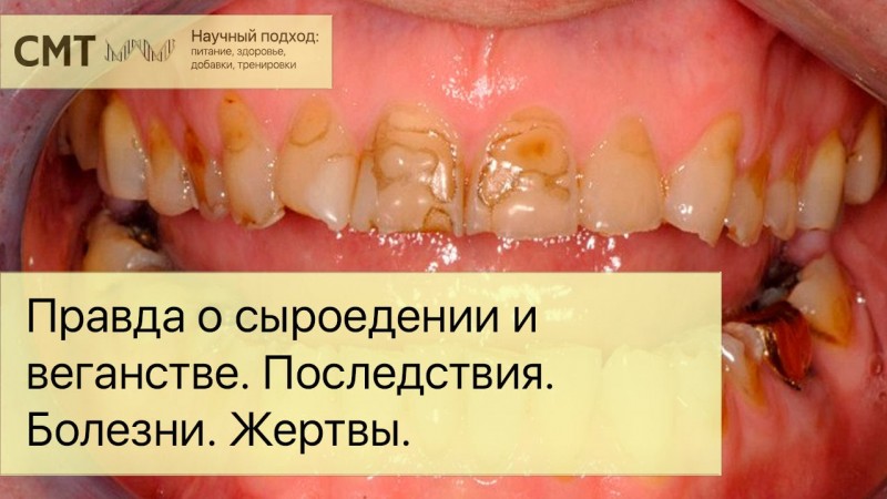 Правда о сыроедении и веганстве. Последствия. Болезни. Жертвы