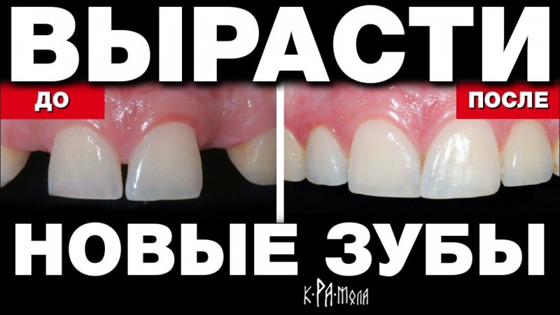 СТОМАТОЛОГАМ ЗАПРЕЩЕНО ОБ ЭТОМ ГОВОРИТЬ. ВЫРАЩИВАНИЕ НОВЫХ ЗУБОВ ВОЗМОЖНО В ЛЮБОМ ВОЗРАСТЕ. ДОКАЗАНО